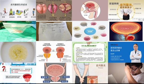 前列腺炎症该怎么办 - 汕头前列腺炎症出现会有什么状况