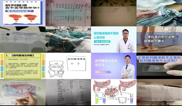 取前列腺液很难受吗 - 汕头取前列腺液感受