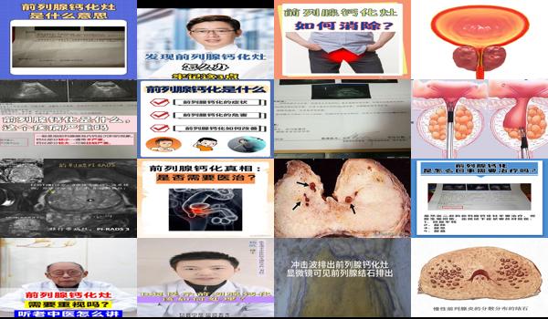 汕头什么叫前列腺化灶病人 - 汕头什么叫前列腺化灶