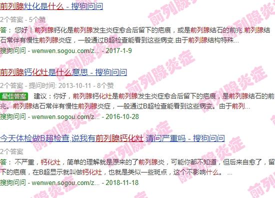 汕头什么叫前列腺化灶病人 - 汕头什么叫前列腺化灶