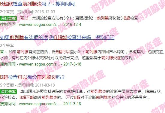 前列腺炎可以b超检查吗 - 汕头前列腺炎b超可以吗