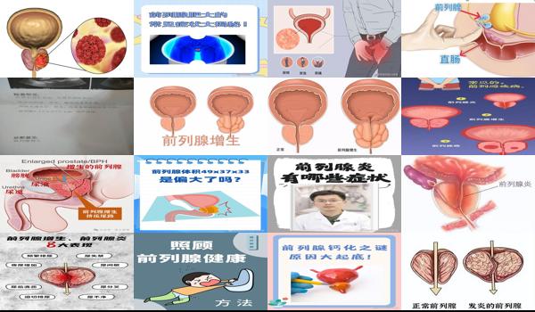 前列腺肥大是个什么病 - 汕头前列腺大是什么