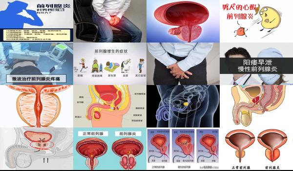 性生活多了会影响前列腺吗 - 汕头男人做爱多了会影响前列腺炎症吗